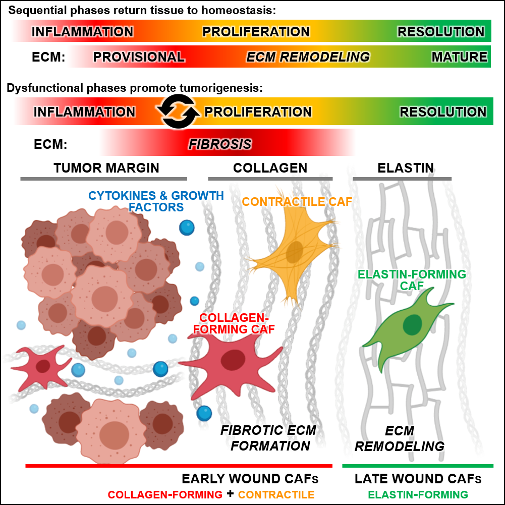 New Study Identifies Cancer Associated Fibroblast Subtypes Based On